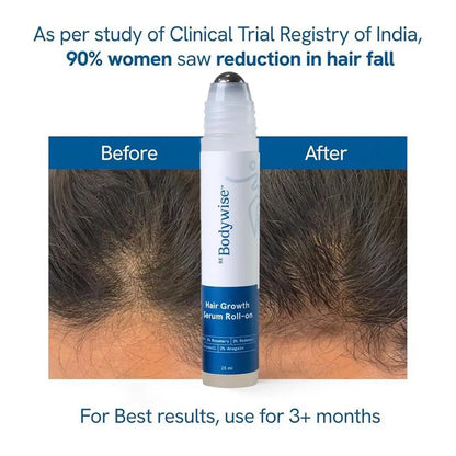 25ml 3% Rosemary Hair Growth Serum - Deep Scalp Nourishment Frizz Control Strengthen Hair Roots Hair Care Essence Oil